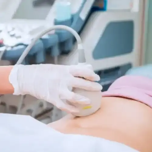 Ecografa plvica suprapbica