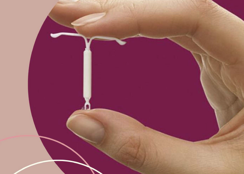 Colocacin de dispositivo intrauterino Mirena