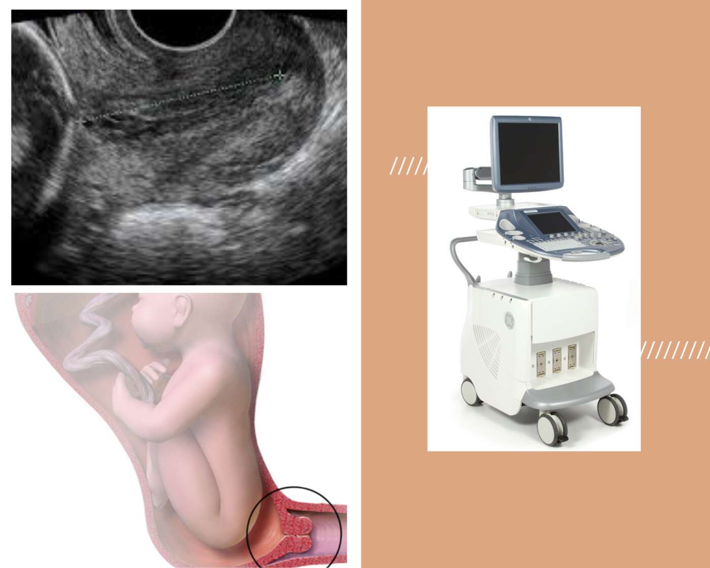 Imagen de Cervicometria