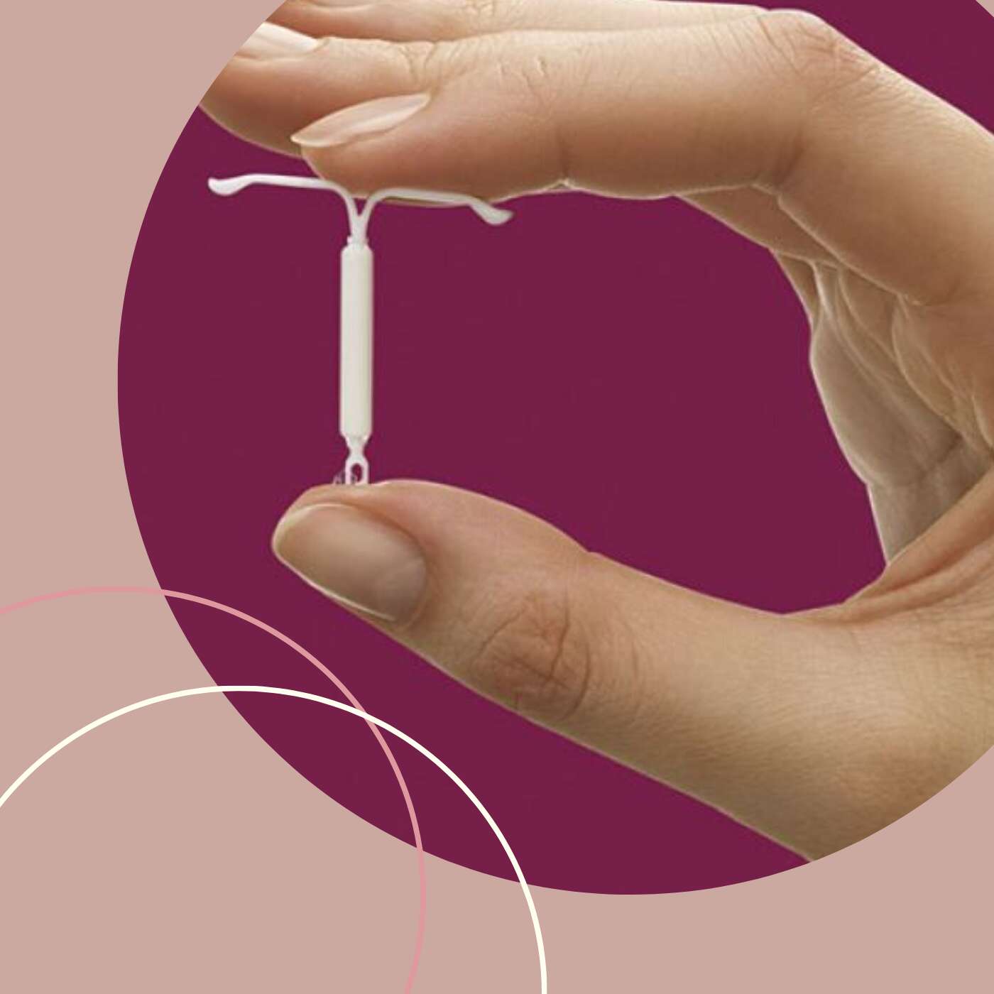 Imagen de Colocación o retiro de dispositivo intrauterino