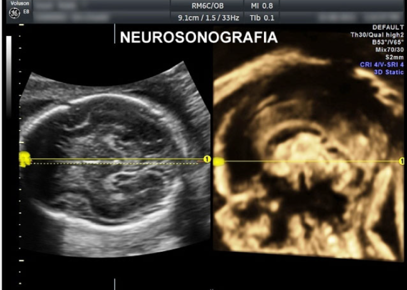 Imagen de 