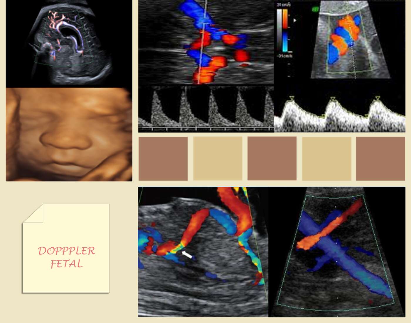 Doppler fetal - Placentario