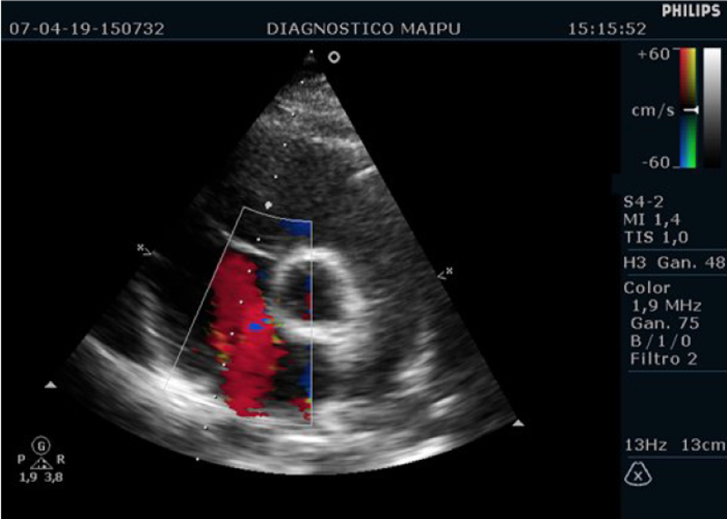 Ecocardiografia fetal